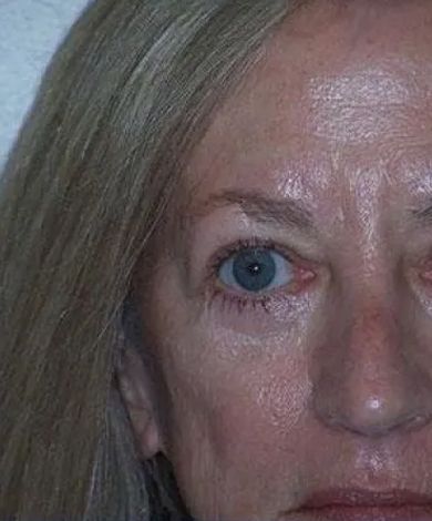 Close-up of a person's face with light-colored hair and a blue eye, showing skin texture and wrinkles.