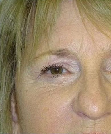 Close-up of a person's eye with wrinkles, light skin, and blonde hair.