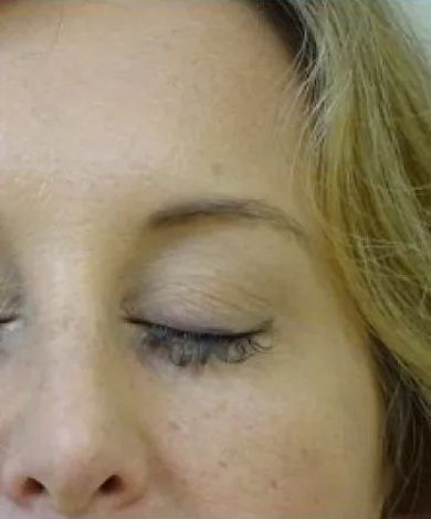 Close-up of a closed eye. Pale skin with some freckles. Eye has short lashes and a curved eyebrow.