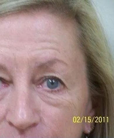 Close-up of a person's eye, showing blue iris and wrinkles around the eye.