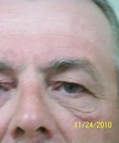 Close-up of a person's face; eye, eyebrow, and nose are visible. The date '11/24/2010' is in the lower right.