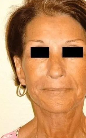 Woman with short brown hair, sun-damaged skin, and a neutral expression. Wearing gold hoop earrings.