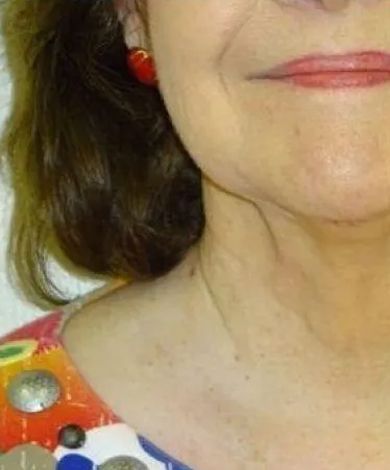 Close-up of a person's face and neck, with a red earring visible, smiling.