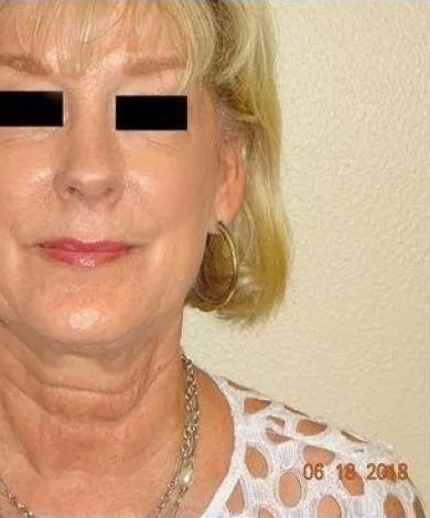 Woman's face and upper chest, wearing a white cut-out shirt and gold hoop earring.