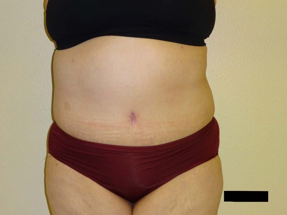 Torso of a person wearing a black top and red underwear, with visible stomach.