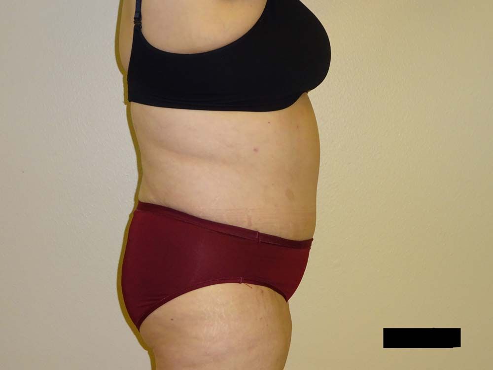 Side view of a person wearing a black bra and burgundy underwear, revealing their torso and thighs.