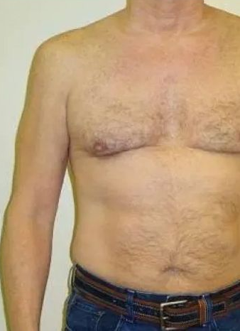 Naked torso with one arm visible. Jeans and belt are worn. The man is standing indoors with his arm bent.