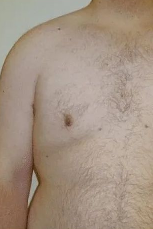 Man's upper torso, right arm visible. Skin-toned, slight curve to the shoulder. Hairy chest.