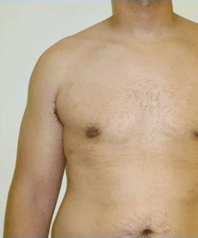 Torso of a person with one arm visible, pale skin, slightly hunched posture.