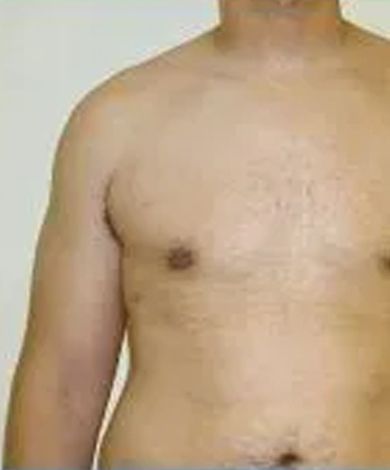 Torso and left arm of a person; skin is light brown, with sparse body hair.