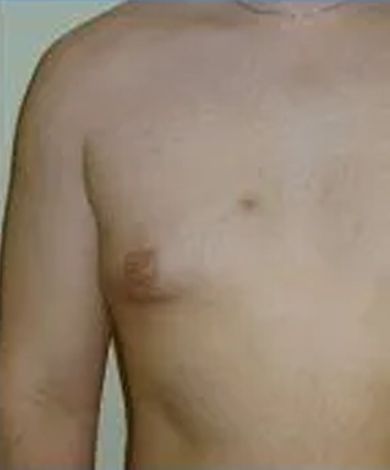 Chest of a person, with a visible nipple on the left side.