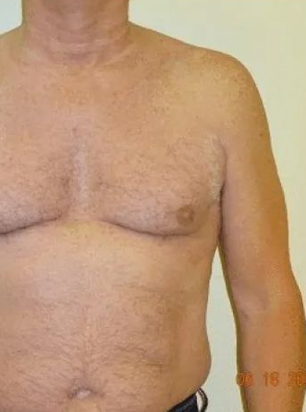 A person's upper torso with the right arm extended, appearing against a plain wall.