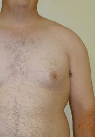 Man's bare torso and right arm visible, with a rounded shoulder and arm hanging down.