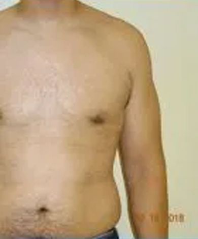 Torso of a person with visible chest and arm. Light skin tone, tan background.