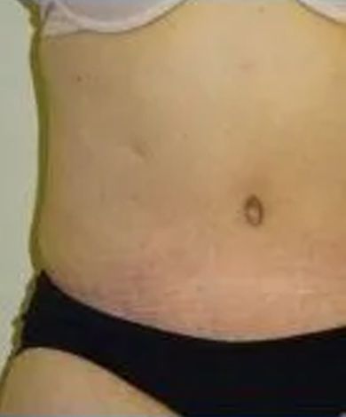 Abdomen with dark bikini bottoms, light skin, and a visible navel.