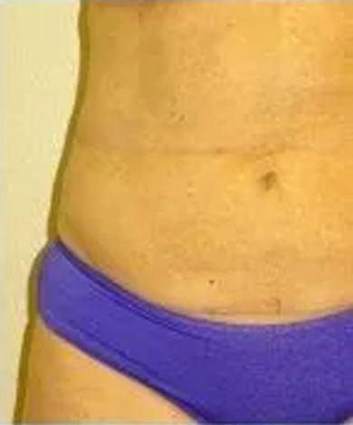 Close-up of a person's torso and upper hip area wearing blue underwear. The skin is light-toned.