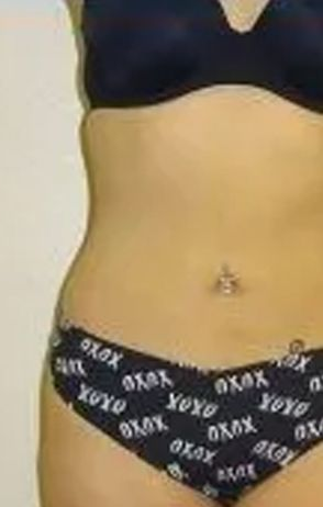Woman's torso wearing a dark blue bra and black underwear with 'xoxo' print; belly button piercing visible.