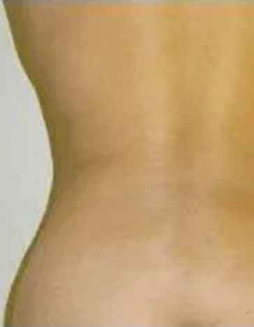 Torso, showing the back and hip curves; tan skin, neutral lighting.