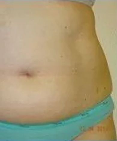 Abdomen in blue underwear; skin is light-toned.