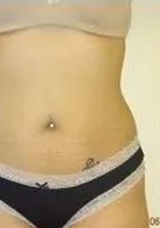 Close-up of a person's torso. They have a belly button piercing and a small tattoo. They are wearing black underwear.