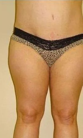 Torso and legs of a person, wearing patterned underwear. Beige wall backdrop.