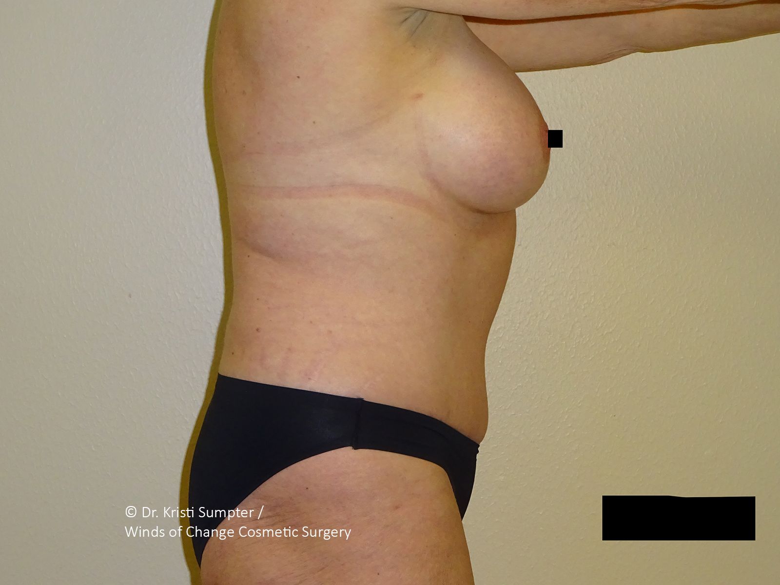 Side view of a person's torso and chest area against a plain wall.