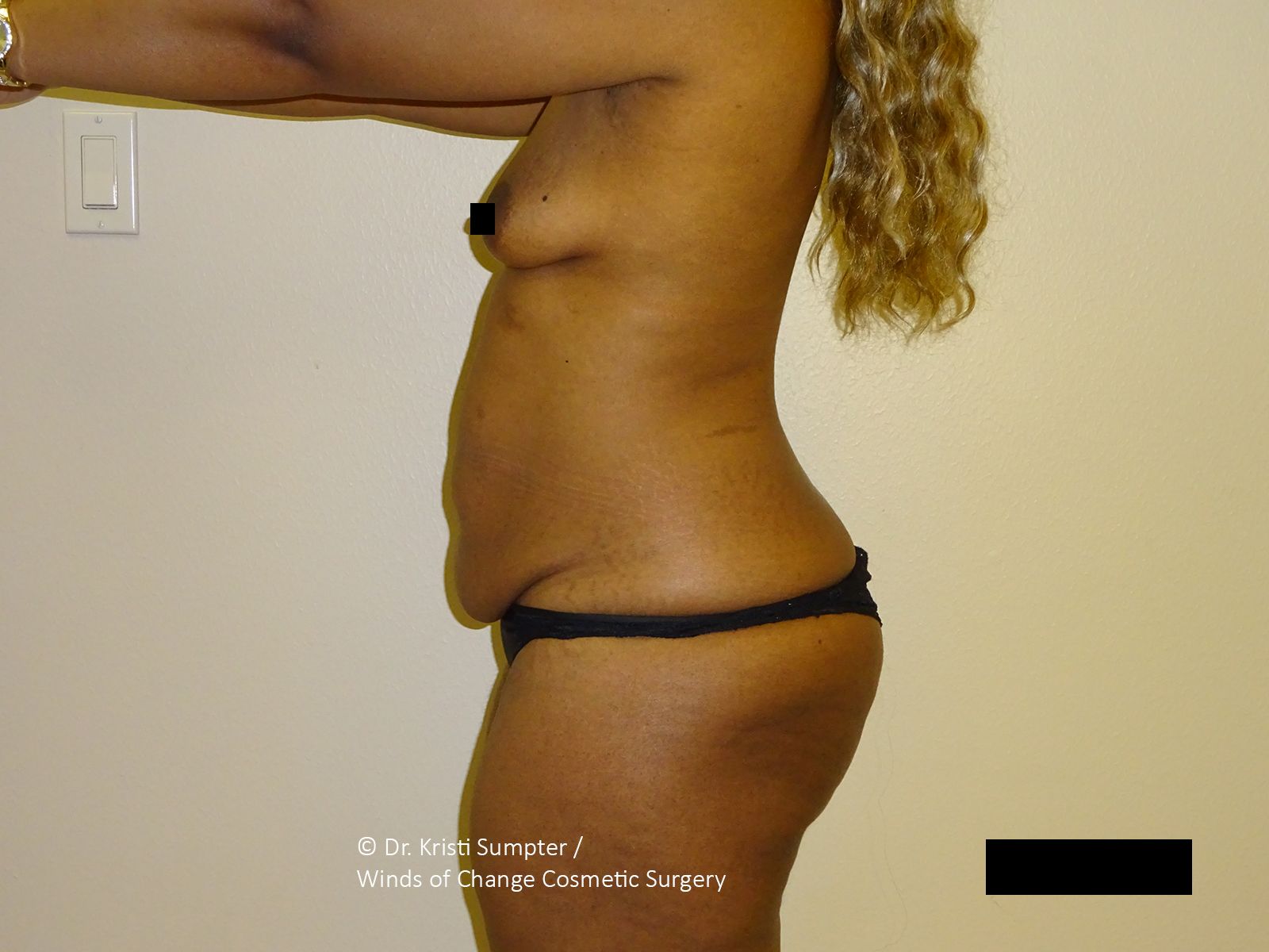 Side profile of a person’s abdomen and torso standing against a neutral wall.