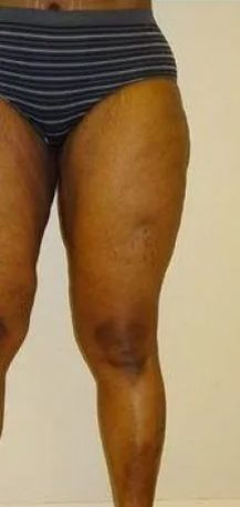 Person's legs in underwear, against a cream-colored wall, with a chair on the right side.