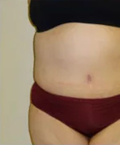 Torso with burgundy underwear and a black bra. Light skin and a simple backdrop.