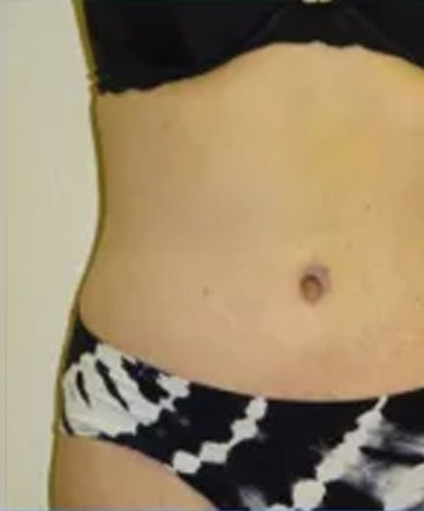 Torso wearing a black bra and patterned bikini bottoms; showing the abdomen and navel.