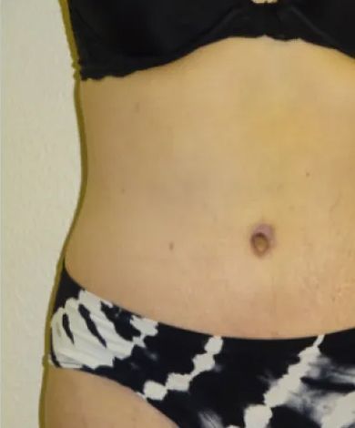 Abdomen of a person wearing a black bra and patterned underwear, showcasing the torso and navel.