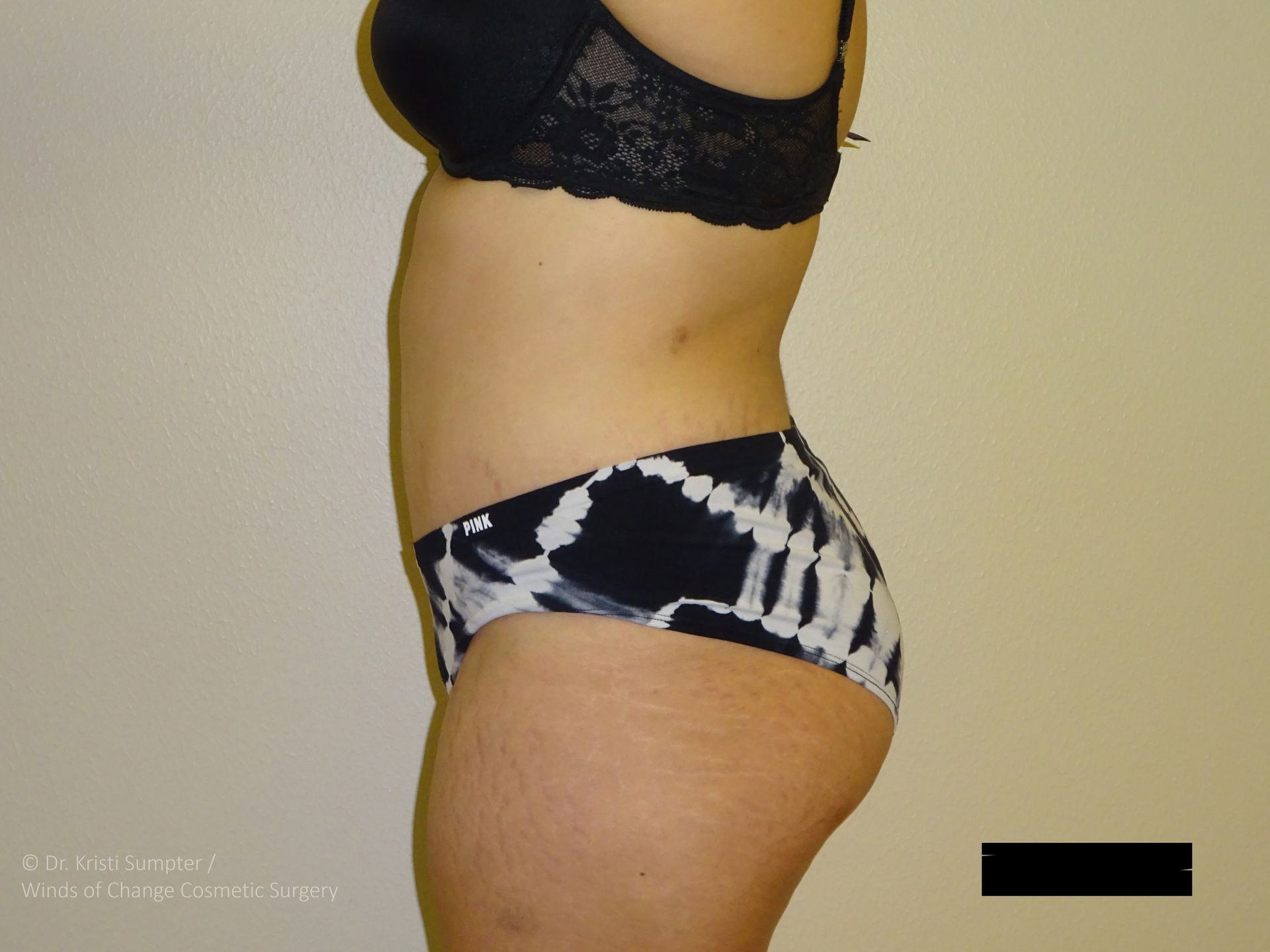 Woman in black bra and patterned underwear, side view, standing against a beige wall.