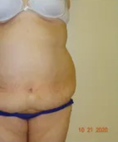 Close-up of a person's torso in a bra and underwear, with a visible belly. Date stamp in lower right corner.