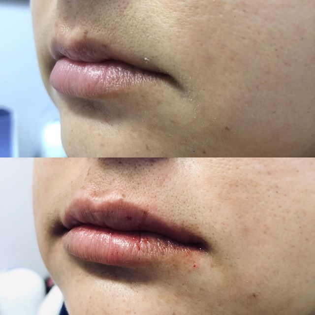 Before and after image