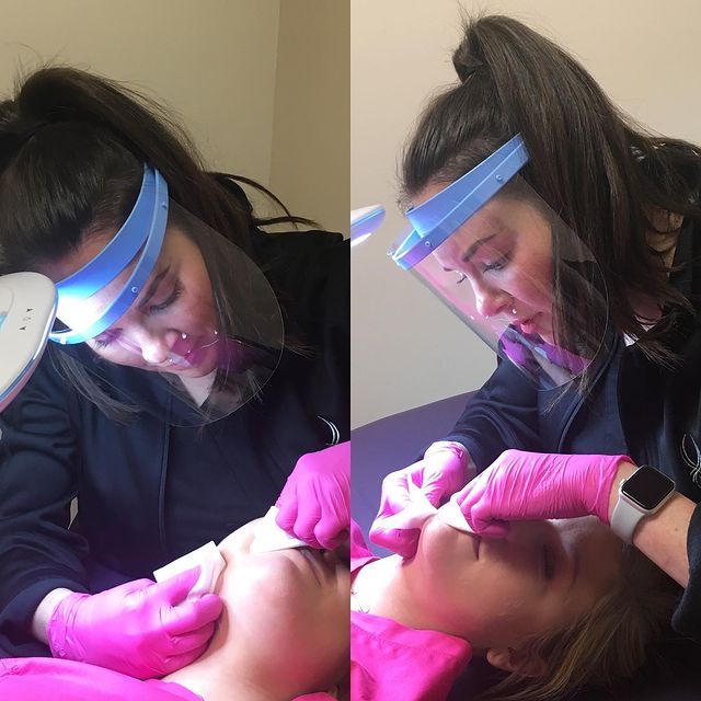 Dermal fillers