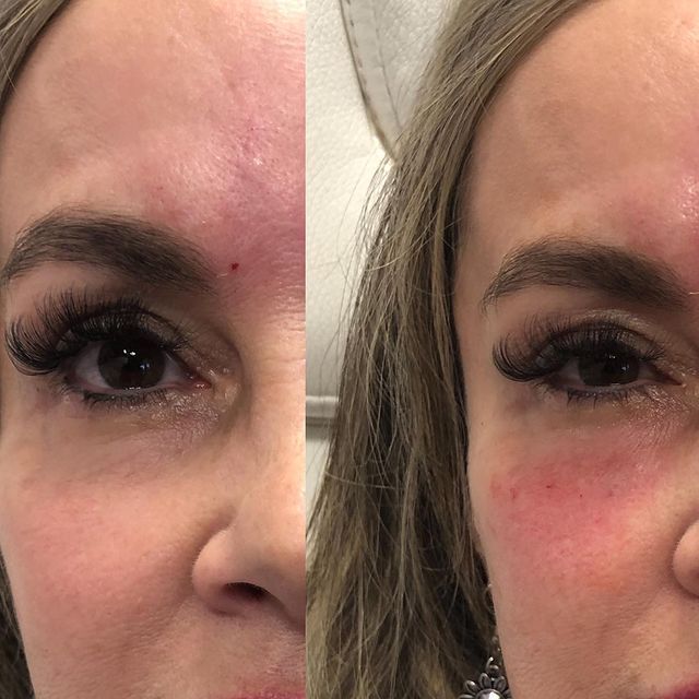 Before and after image