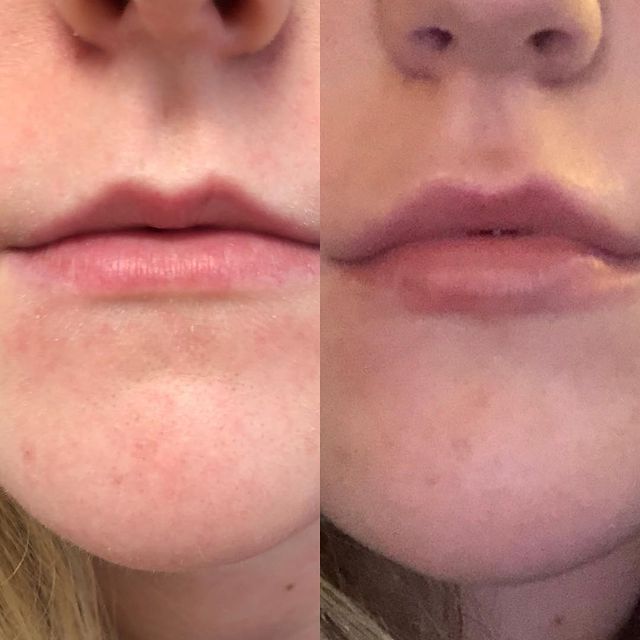 Before and after image