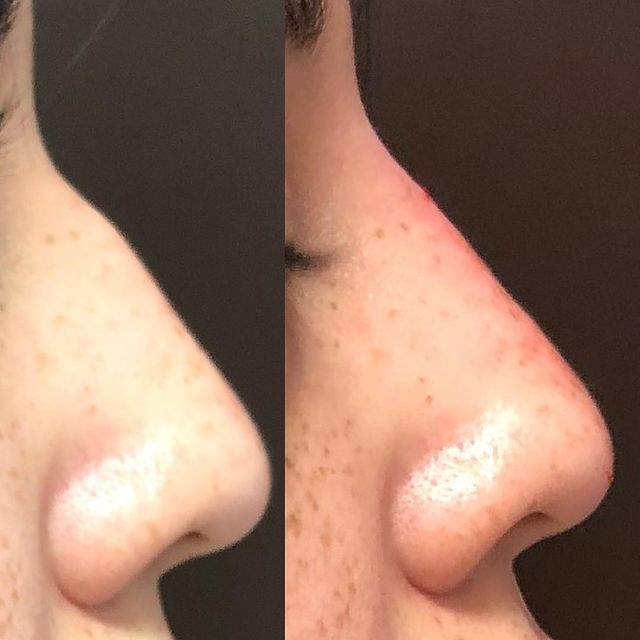 Before and after image