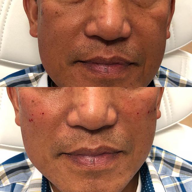 Before and after image