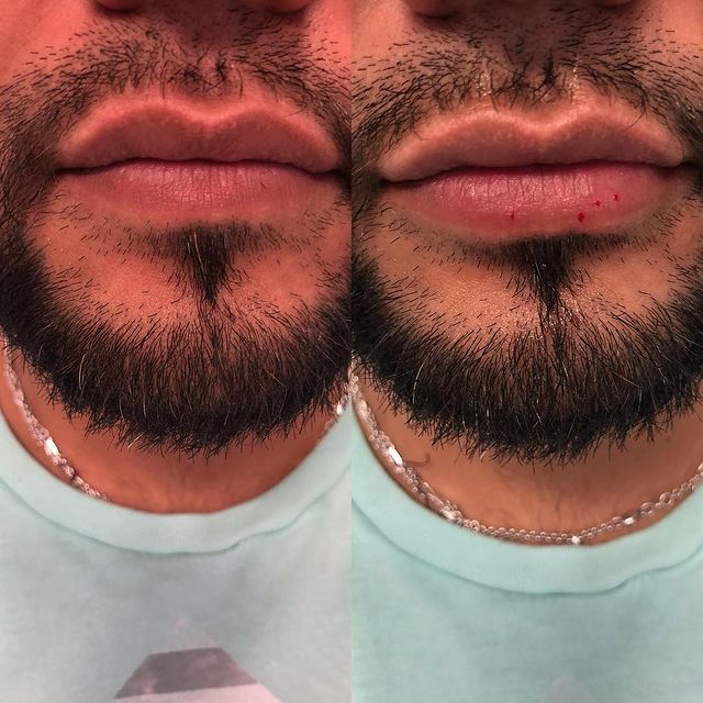 Before and after image