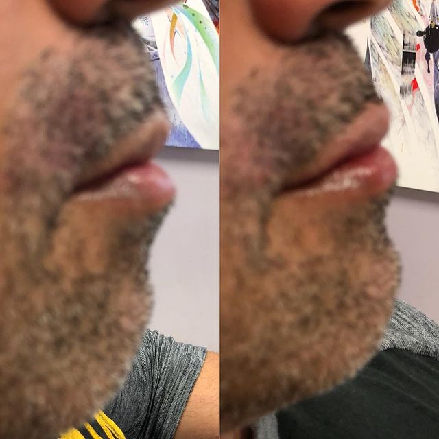 Before and after image