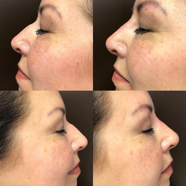 Before and after image