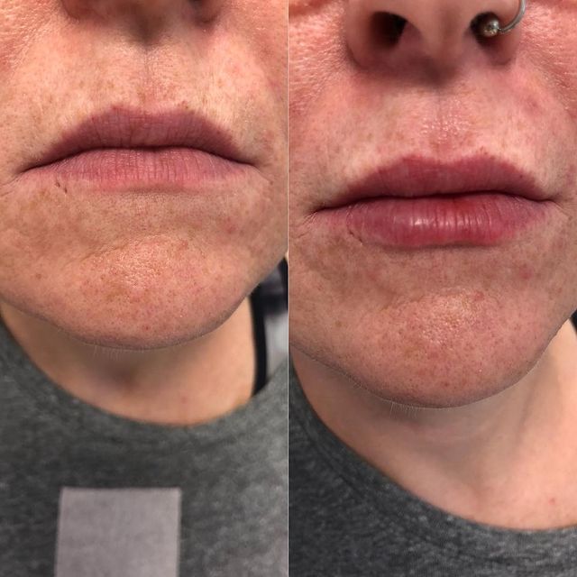 Before and after image