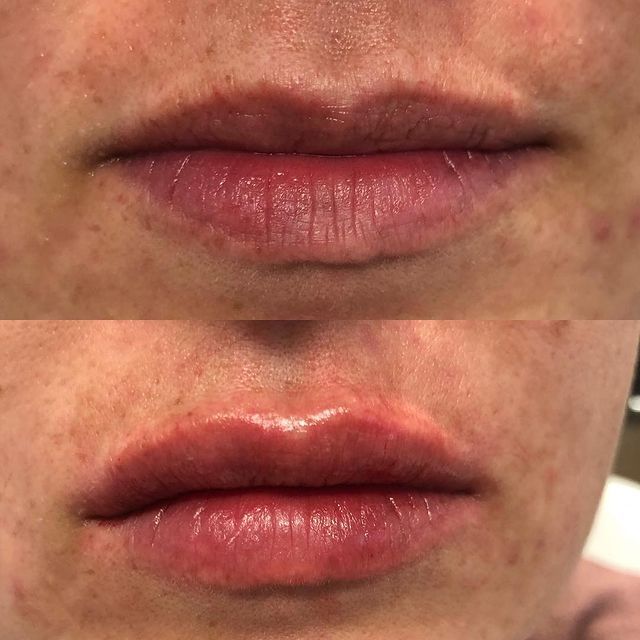 Before and after image