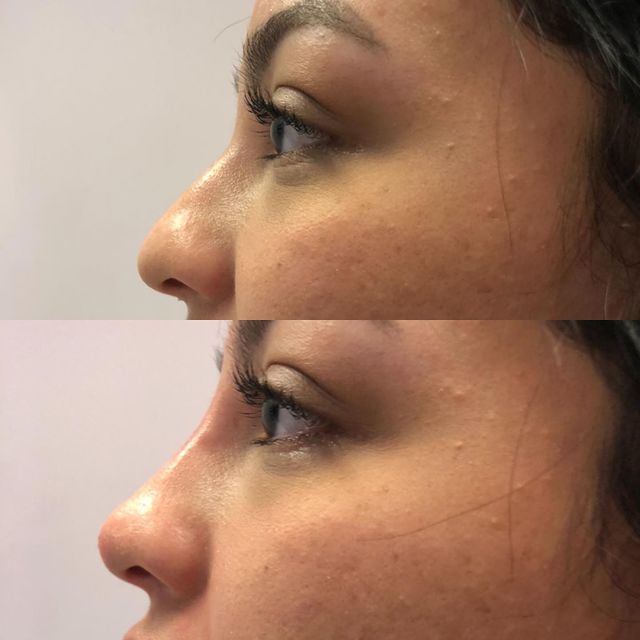 Before and after image