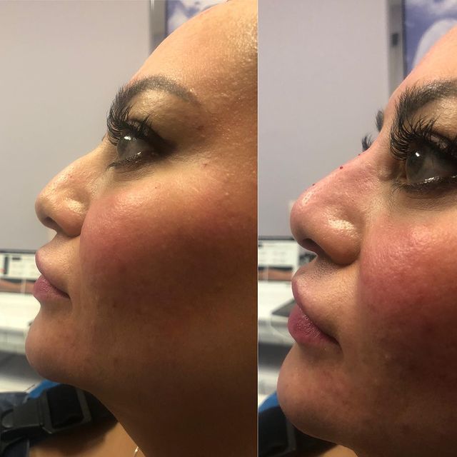 Before and after image