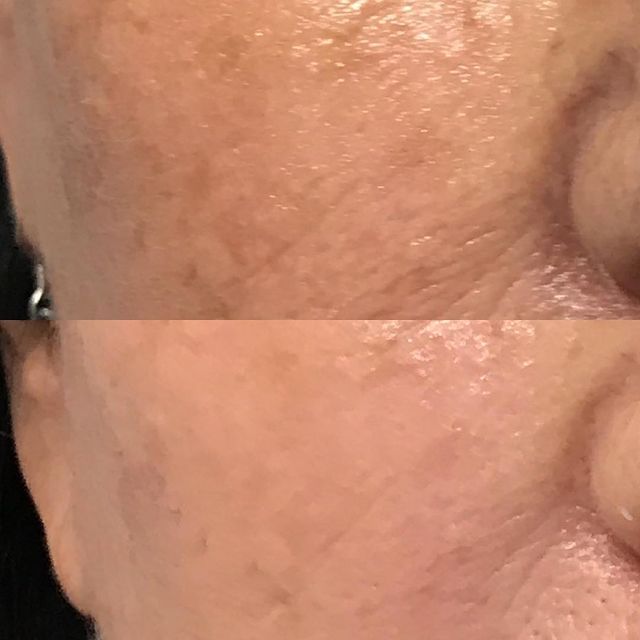 Before and after image