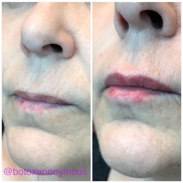 Before and after image