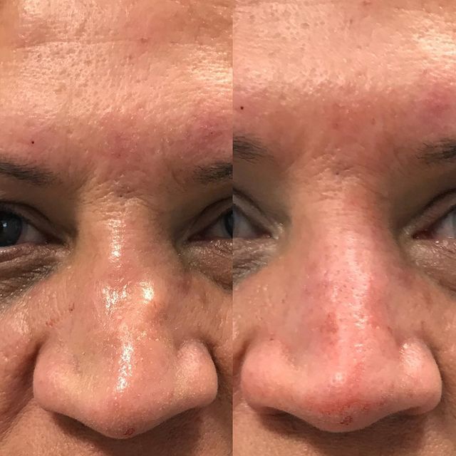 Before and after image