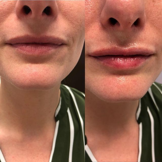 Before and after image